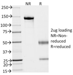 EpCAM/TROP1 Antibody (EGP40/837) - (ECD), Novus Biologicals 0.2mg; Unlabeled:Antibodies,